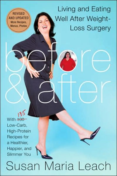 Before and After: Living Eating Well After Weight-Loss Surgery (Revised Edition)
