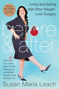 Title: Before & After: Living and Eating Well After Weight-Loss Surgery, Author: Susan Maria Leach