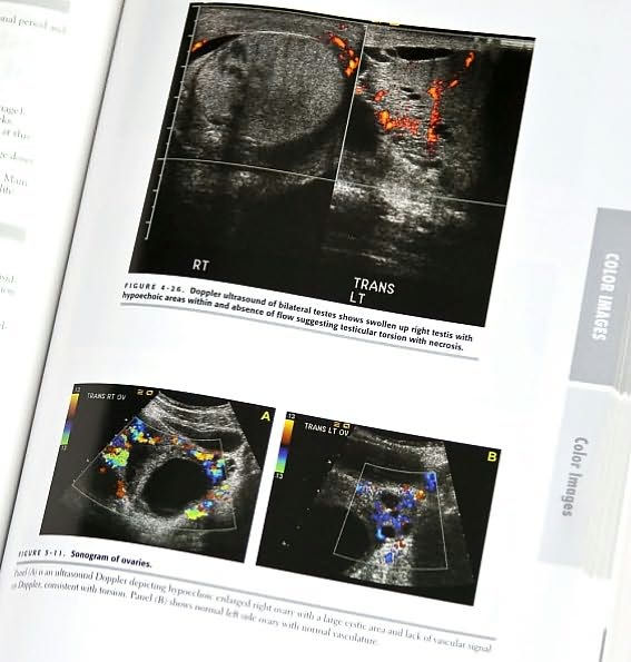 First Aid Radiology for the Wards / Edition 1