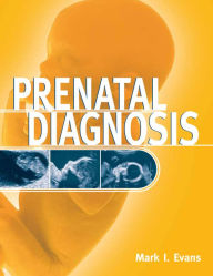 Title: Prenatal Diagnosis, Author: Mark I. Evans