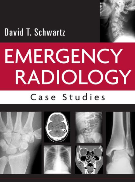 Emergency Radiology: Case Studies