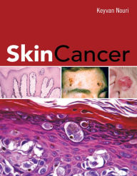 Title: Skin Cancer, Author: Keyvan Nouri