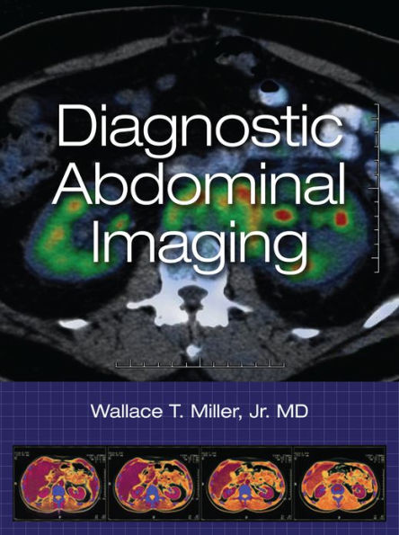 Diagnostic Abdominal Imaging / Edition 1