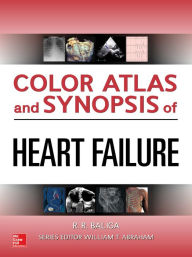 Title: Color Atlas and Synopsis of Heart Failure, Author: Ragavendra Baliga