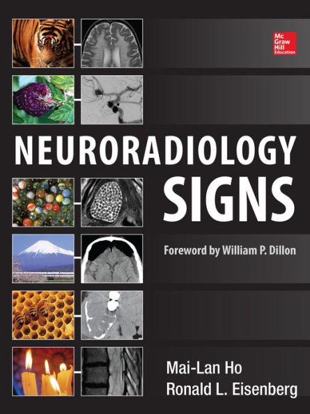 Neuroradiology Signs / Edition 1