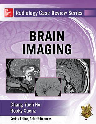 Radiology Case Review Series: Brain Imaging / Edition 1
