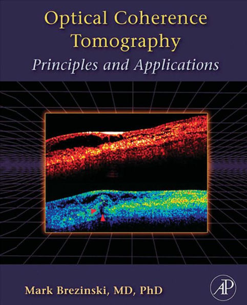 Optical Coherence Tomography: Principles and Applications