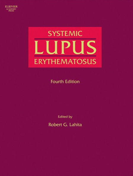 Systemic Lupus Erythematosus