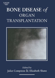 Title: Bone Disease of Organ Transplantation, Author: Juliet Compston