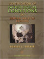 Identification of Pathological Conditions in Human Skeletal Remains