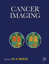 Title: Cancer Imaging: Lung and Breast Carcinomas, Author: M. A. Hayat