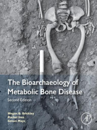 Title: The Bioarchaeology of Metabolic Bone Disease, Author: Megan B. Brickley