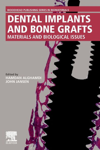 Dental Implants and Bone Grafts: Materials and Biological Issues