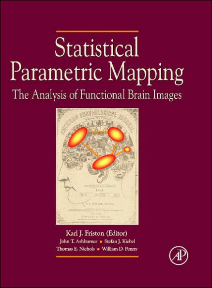 Statistical Parametric Mapping: The Analysis of Functional Brain Images