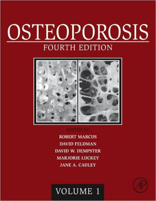 Osteoporosishardcover - 