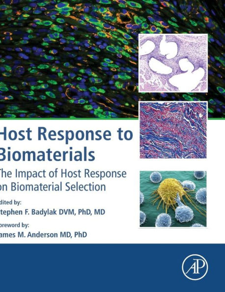 Host Response to Biomaterials: The Impact of Host Response on Biomaterial Selection