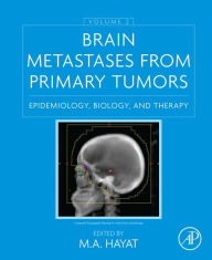 Title: Brain Metastases from Primary Tumors, Volume 2: Epidemiology, Biology, and Therapy, Author: M. A. Hayat