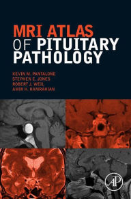 Title: MRI Atlas of Pituitary Pathology, Author: Kevin M. Pantalone DO