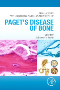 Download kindle books free for ipad Advances in Pathobiology and Management of Paget's Disease of Bone