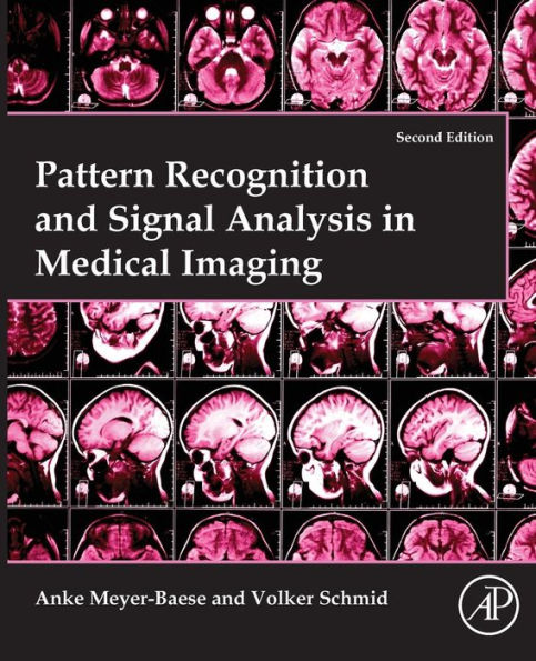 Pattern Recognition and Signal Analysis in Medical Imaging / Edition 2