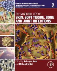 Title: The Microbiology of Skin, Soft Tissue, Bone and Joint Infections, Author: Kateryna Kon