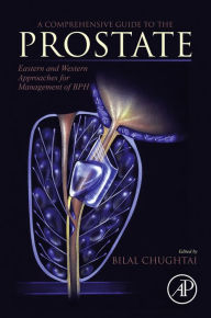 Title: A Comprehensive Guide to the Prostate: Eastern and Western Approaches for Management of BPH, Author: Bilal Chughtai
