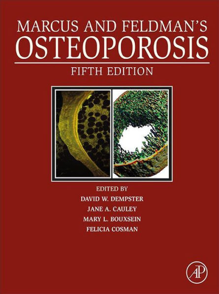 Marcus and Feldman's Osteoporosis