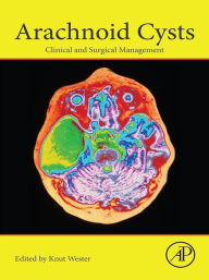 Title: Arachnoid Cysts: Clinical and Surgical Management, Author: Knut Wester