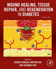 Title: Wound Healing, Tissue Repair, and Regeneration in Diabetes, Author: Debasis Bagchi PhD