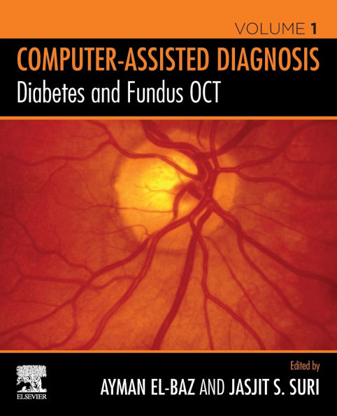 Diabetes and Fundus OCT