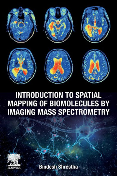 Introduction to Spatial Mapping of Biomolecules by Imaging Mass Spectrometry