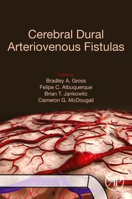 Cerebral Dural Arteriovenous Fistulas