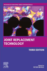 Title: Joint Replacement Technology, Author: Peter A. Revell