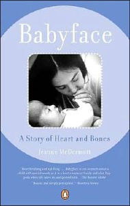 Title: Babyface: A Story of Heart and Bones, Author: Jeanne McDermott