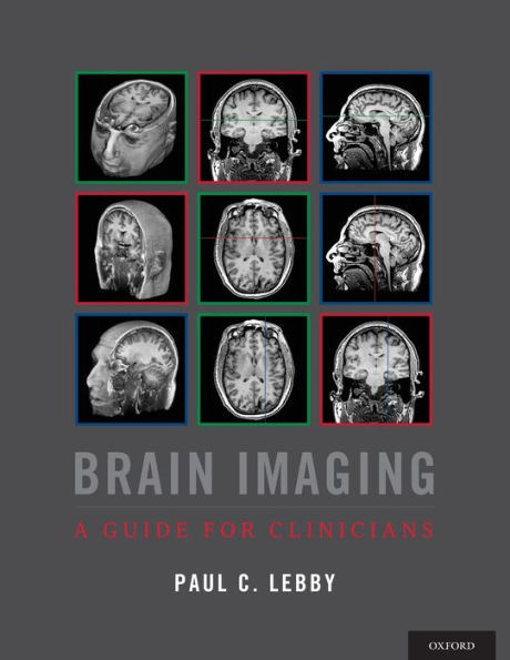 Brain Imaging: A Guide for Clinicians