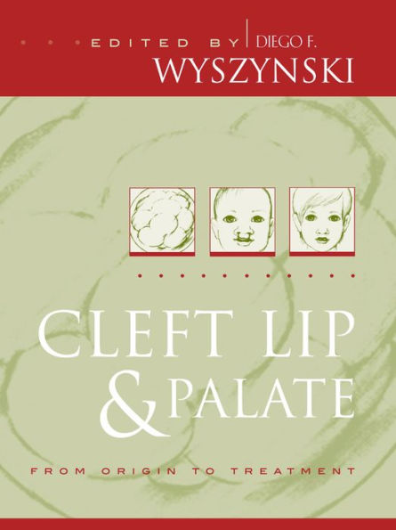 Cleft Lip and Palate: From Origin to Treatment