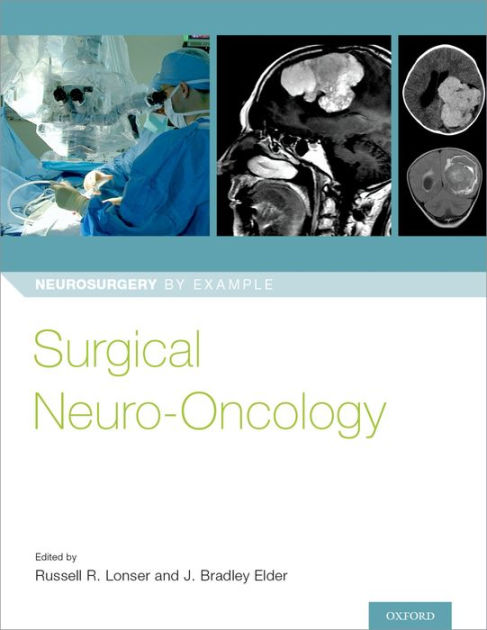 Surgical Neuro-Oncology by Russell R. Lonser | 9780190696696 ...