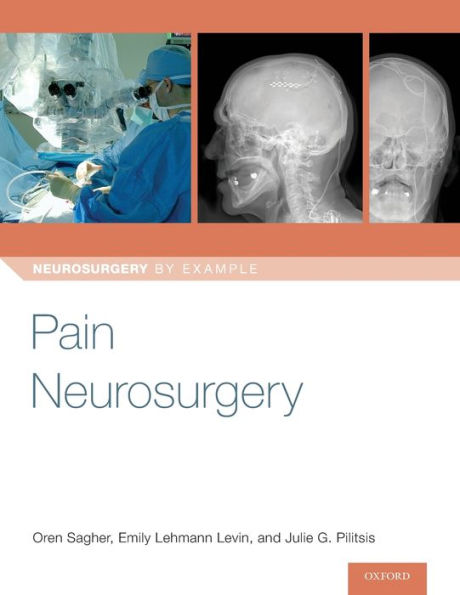 Pain Neurosurgery