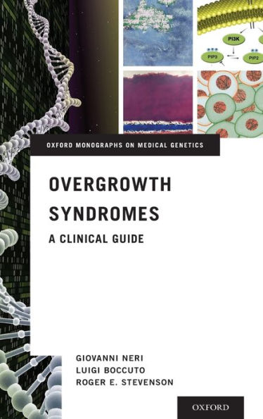 Overgrowth Syndromes: A Clinical Guide
