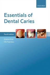 Title: Essentials of Dental Caries, Author: Edwina Kidd