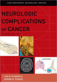 Title: Neurologic Complications of Cancer / Edition 2, Author: Lisa M DeAngelis