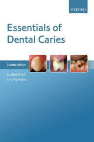 Title: Essentials of Dental Caries / Edition 4, Author: Edwina Kidd