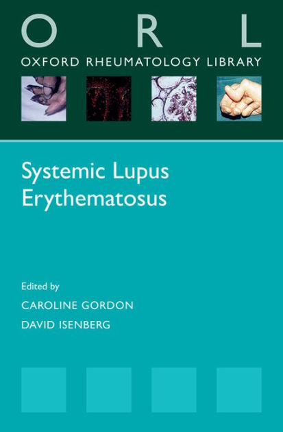 Systemic Lupus Erythematosus by Caroline Gordon | 9780198739180 ...