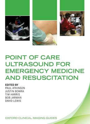 Point of Care Ultrasound for Emergency Medicine and Resuscitation