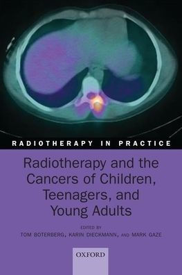 Radiotherapy and the Cancers of Children, Teenagers Young Adults