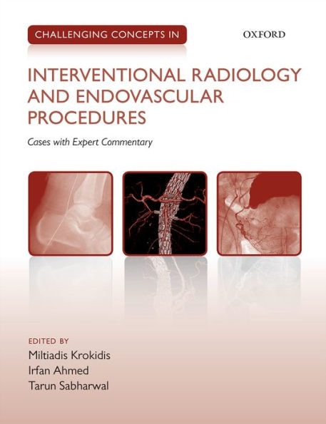 Challenging Concepts in INTERVENTIONAL RADIOLOGY