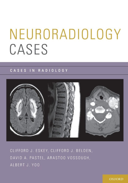 Neuroradiology Cases