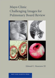 Title: Mayo Clinic Challenging Images for Pulmonary Board Review, Author: Edward C. Rosenow