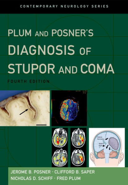 Plum and Posner's Diagnosis of Stupor and Coma