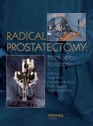 Title: Radical Prostatectomy: From Open to Robotic, Author: Roger Kirby